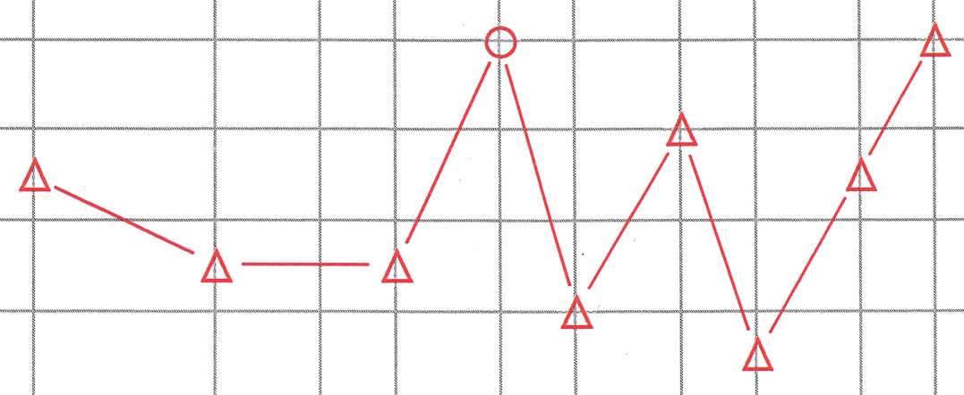 Detail of audiology test